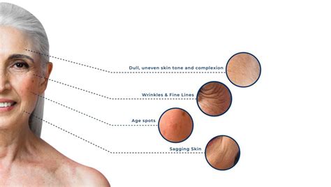 Aging Skin - Ko Skin Specialist